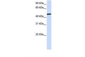 Image no. 1 for anti-Uridine Monophosphate Synthetase (UMPS) (AA 398-447) antibody (ABIN6738421) (UMPS antibody  (AA 398-447))