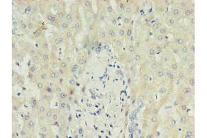 Immunohistochemistry of paraffin-embedded human liver using ABIN7148699 in 30 μg/mL dilute concentrations. (CRP antibody)