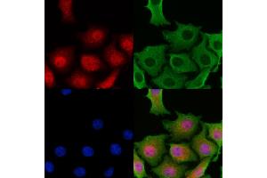 ABIN6265286 and ABIN6269138 staining HepG2 cells by IF/ICC. (SRF antibody  (N-Term))
