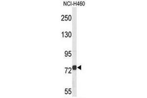 Western blot analysis of CHAT Antibody (N-term) in NCI-H460 cell line lysates (35µg/lane). (Choline Acetyltransferase antibody  (N-Term))