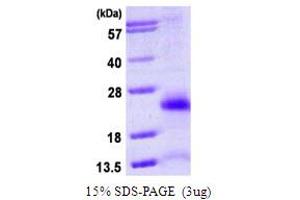 SDS-PAGE (SDS) image for Ubiquitin D (UBD) (AA 1-165) protein (His tag) (ABIN667556) (UBD Protein (AA 1-165) (His tag))
