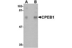 Western blot analysis of CPEB1 in rat brain tissue lysate with AP30241PU-N CPEB1 antibody at (A) 1 and (B) 2 μg/ml. (CPEB1 antibody  (N-Term))