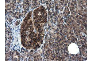 Image no. 2 for anti-CCR4-NOT Transcription Complex Subunit 4 (CNOT4) (AA 190-455) antibody (ABIN1491098) (CNOT4 antibody  (AA 190-455))