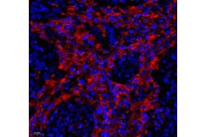 Immunofluorescence of paraffin embedded human colon using LRP (ABIN7074548) at dilution of 1: 250 (400x lens) (MVP antibody)