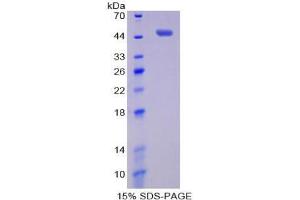 SDS-PAGE analysis of Human Pim-1 Oncogene Protein.