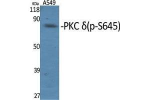 Western Blot (WB) analysis of specific cells using Phospho-PKC delta (S645) Polyclonal Antibody.