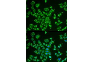 Immunofluorescence analysis of HeLa cells using SMAD1 antibody. (SMAD1 antibody)