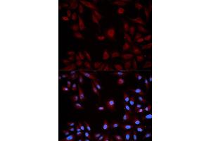 Immunofluorescence analysis of HeLa cell using STAT5B antibody. (STAT5B antibody  (AA 40-280))