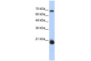 CHCHD4 antibody used at 1 ug/ml to detect target protein. (CHCHD4 antibody  (N-Term))