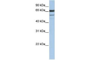 WB Suggested Anti-SEPN1 Antibody Titration:  1 ug/ml  Positive Control:  Hela cell lysate