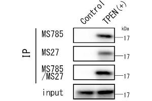 Detection of endogenous SOD1 wild type under ER-stress HEK293 cells were cultured in the presence and absence of 10 M TPEN, a potent zinc-specific chelator, for 8 hours.
