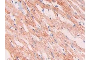 Detection of Slit1 in Rat Heart Tissue using Polyclonal Antibody to Slit Homolog 1 (Slit1) (SLIT1 antibody  (AA 308-512))