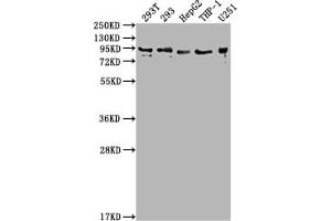 Western Blot Positive WB detected in: 293T whole cell lysate, 293 whole cell lysate, HepG2 whole cell lysate, THP-1 whole cell lysate, U251 whole cell lysate All lanes: CCHCR1 antibody at 1:2000 Secondary Goat polyclonal to rabbit IgG at 1/50000 dilution Predicted band size: 89, 100, 96 kDa Observed band size: 89 kDa (CCHCR1 antibody  (AA 281-500))