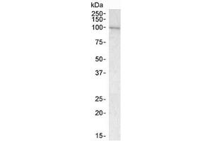Western blot testing of human bone marrow lysate with VAV3 antibody at 1ug/ml. (VAV3 antibody)
