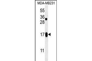 C4orf34 Antibody (C-term) (ABIN651629 and ABIN2840335) western blot analysis in MDA-M cell line lysates (35 μg/lane). (SMIM14 antibody  (C-Term))