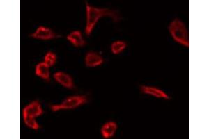 ABIN6266793 staining Hela by IF/ICC. (C1orf57 antibody  (C-Term))