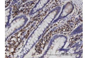 Immunoperoxidase of monoclonal antibody to AKR1B1 on formalin-fixed paraffin-embedded human small Intestine.