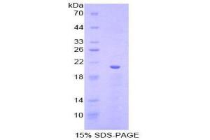 SDS-PAGE (SDS) image for Von Willebrand Factor (VWF) (AA 1167-1334) protein (His tag) (ABIN2122338) (VWF Protein (AA 1167-1334) (His tag))