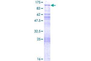 Image no. 1 for Glutaminyl-tRNA Synthetase (QARS) (AA 1-775) protein (GST tag) (ABIN1316994) (QARS Protein (AA 1-775) (GST tag))