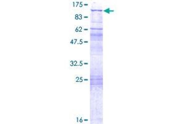 QARS Protein (AA 1-775) (GST tag)