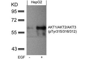 Western blot analysis of extracts from HepG2 cells untreated or treated with EGF using AKT1/AKT2/AKT3(phospho-Tyr315/316/312) Antibody.