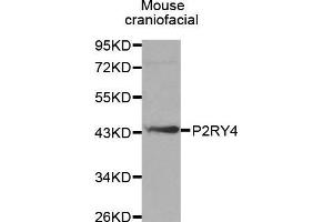Western Blotting (WB) image for anti-Pyrimidinergic Receptor P2Y, G-Protein Coupled, 4 (P2RY4) (AA 286-365) antibody (ABIN3017282) (P2RY4 antibody  (AA 286-365))
