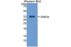 Western blot analysis of the recombinant protein. (Integrin alpha 1 antibody  (AA 103-368))