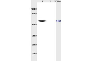 Lane 1: human colon carcinoma lysates Lane 2: rat brain lysates probed with Anti CD166 Polyclonal Antibody, Unconjugated (ABIN673944) at 1:200 in 4 °C. (CD166 antibody  (AA 451-583))