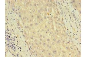 Immunohistochemistry of paraffin-embedded human liver tissue using ABIN7150765 at dilution of 1:100 (DUSP26 antibody  (AA 1-211))
