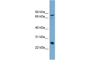 WB Suggested Anti-KLK5 Antibody Titration:  0. (Kallikrein 5 antibody  (N-Term))