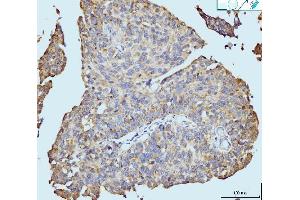 IHC analysis of Neurofibromin/NF1 using anti-Neurofibromin/NF1 antibody (ABIN7600197).