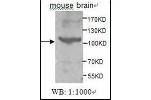 Western Blotting (WB) image for anti-tyrosine Kinase, Non-Receptor, 2 (TNK2) (AA 278-289) antibody (ABIN955283) (TNK2 antibody  (AA 278-289))
