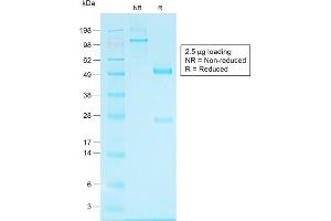 SDS-PAGE Analysis of Purified Glypican-3 Rabbit Recombinant Monoclonal Antibody (GPC3/1534R). (Glypican 3 antibody)