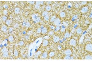 Immunohistochemistry of paraffin-embedded Rat brain using SYP Polyclonal Antibody at dilution of 1:100 (40x lens). (Synaptophysin antibody)