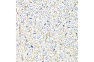 Immunohistochemistry of paraffin-embedded mouse liver using ABCA6 antibody (ABIN1870712) at dilution of 1:100 (40x lens). (ABCA6 antibody)