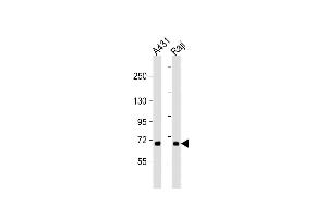 All lanes : Anti-P3K5 Antibody  at 1:2000 dilution Lane 1: A431 whole cell lysate Lane 2: Raji whole cell lysate Lysates/proteins at 20 μg per lane. (ASK1 antibody  (AA 821-849))