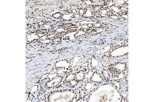 IHC analysis of SNRNP200 using anti-SNRNP200 antibody (ABIN7602032). (SNRNP200 antibody  (AA 557-2129))