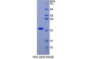 Image no. 1 for Superoxide Dismutase 1, Soluble (SOD1) (AA 2-154) protein (His tag) (ABIN1171401)