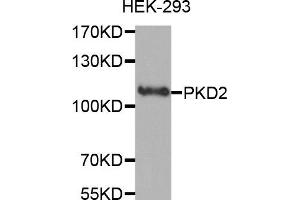 Western Blotting (WB) image for anti-Polycystic Kidney Disease 2 (Autosomal Dominant) (PKD2) antibody (ABIN1874147) (PKD2 antibody)