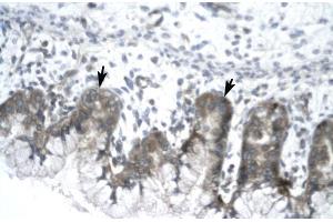 Human Stomach; IVNS1ABP antibody - N-terminal region in Human Stomach cells using Immunohistochemistry (IVNS1ABP antibody  (N-Term))