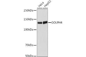 Western blot analysis of extracts of various cell lines, using GOLPH4 antibody (ABIN7267488) at 1:1000 dilution. (Golgi Integral Membrane Protein 4 (GOLIM4) antibody)