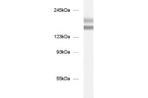 dilution: 1 : 1000, sample: mouse brain homogenate (Tenascin R antibody)
