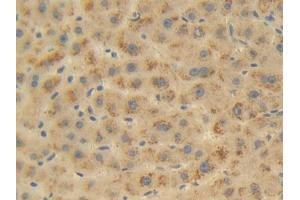 Used in DAB staining on fromalin fixed paraffin-embedded Liver tissue (FKBP1B antibody  (AA 2-108))