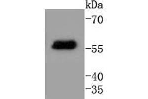 293T cell lysates probed with Cytokeratin 4 (2F9) Monoclonal Antibody  at 1:1000 overnight at 4˚C. (KRT4 antibody)