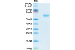 Mouse CD160 on Tris-Bis PAGE under reduced condition. (CD160 Protein (CD160) (AA 28-160) (Fc Tag))