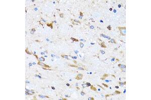 Immunohistochemistry of paraffin-embedded mouse spinal cord using PTRH2 antibody (ABIN5973864) at dilution of 1/100 (40x lens). (PTRH2 antibody)