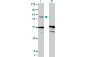 Western Blot analysis of MMP13 expression in transfected 293T cell line by MMP13 monoclonal antibody (M07), clone 3B11. (MMP13 antibody  (AA 362-471))