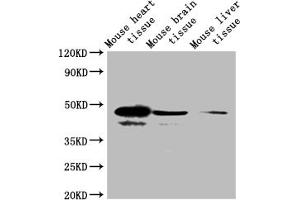 Western blot All lanes: Selenoprotein P antibody at 2 μg/mL + Mouse heart tissue Secondary Goat polyclonal to rabbit IgG at 1/10000 dilution Predicted band size: 43 kDa Observed band size: 43 kDa (Selenoprotein P (SELENOP) (AA 20-381) antibody)