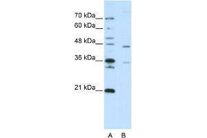 WB Suggested Anti-ZNF488 Antibody Titration:  2. (ZNF488 antibody  (C-Term))