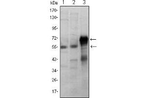 Western blot analysis using ETS1 mouse mAb against Jurkat (1), HepG2 (2) and ETS1-hIgGFc transfected HEK293 (3) cell lysate. (ETS1 antibody)